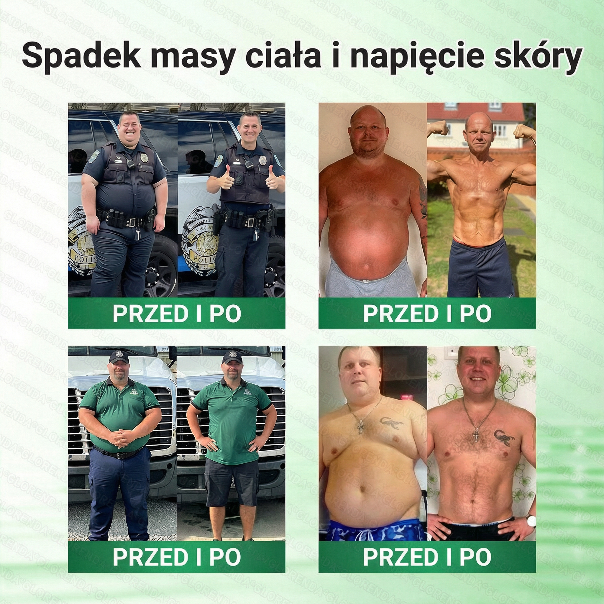 🇵🇱 Oficjalny Sklep|🔍Glorenda® Moringa · Berberyna × NAD+ 10-w-1 Zaawansowana Nano Mikronakłuwająca Plaster (tylko raz dziennie, widoczne efekty już po 7 dniach) ✅ Dla osób z otyłością, luźną skórą, cukrzycą, bezdechem sennym, problemami stawowymi i inn