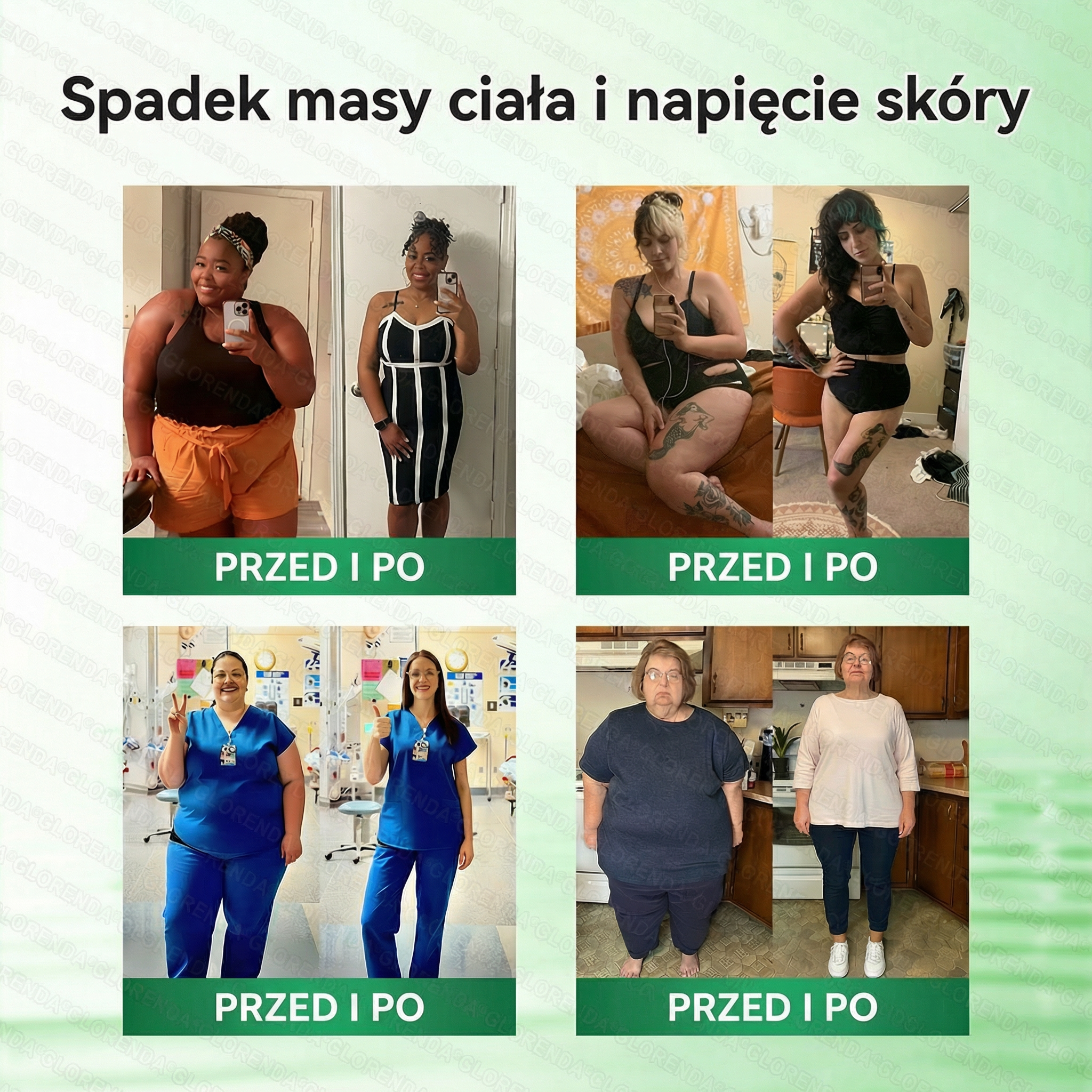 🇵🇱 Oficjalny Sklep|🔍Glorenda® Moringa · Berberyna × NAD+ 10-w-1 Zaawansowana Nano Mikronakłuwająca Plaster (tylko raz dziennie, widoczne efekty już po 7 dniach) ✅ Dla osób z otyłością, luźną skórą, cukrzycą, bezdechem sennym, problemami stawowymi i inn